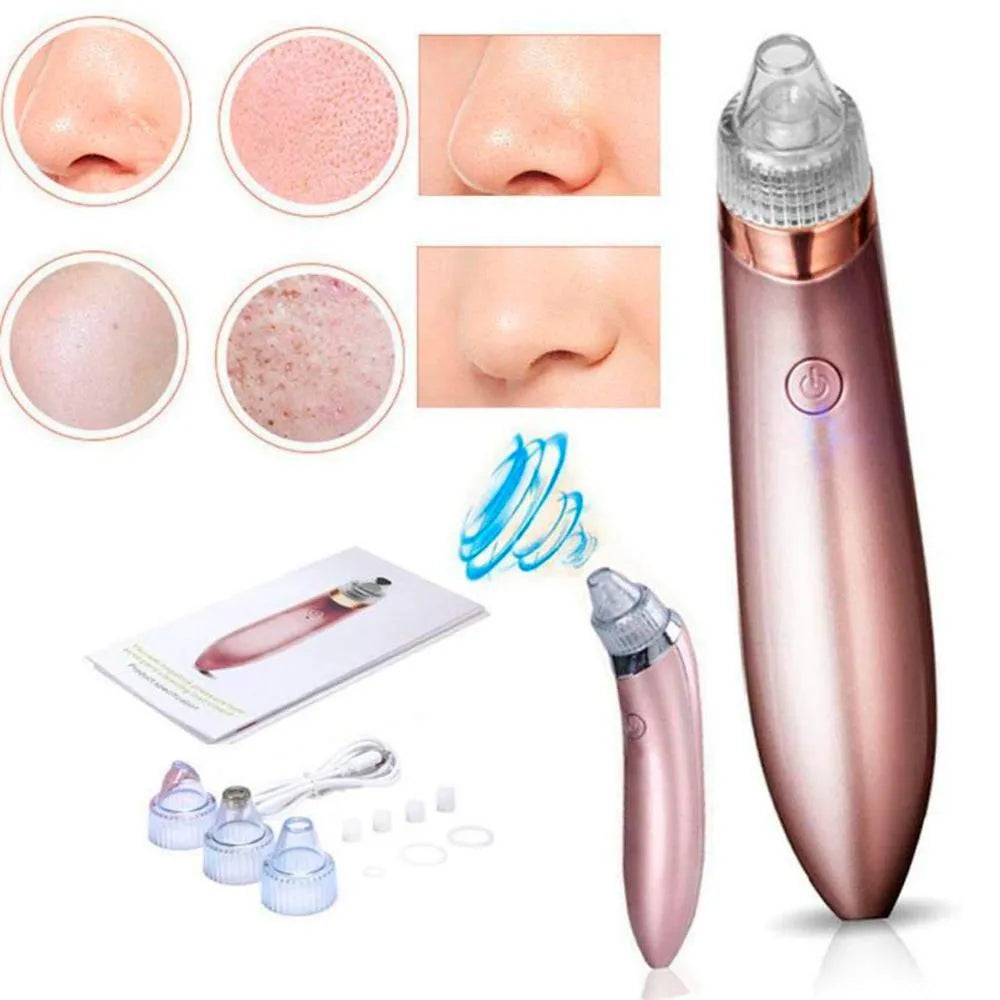 ✨🧖‍♀️ Extractor de Puntos Negros y Espinillas