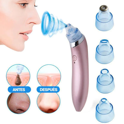 ✨🧖‍♀️ Extractor de Puntos Negros y Espinillas